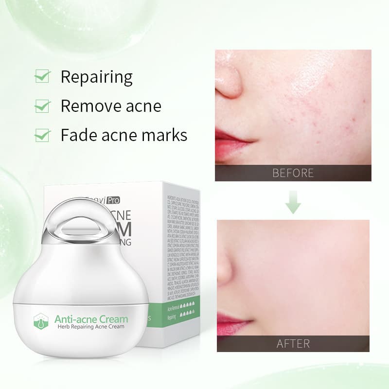 Herbal Skin care lotion Moisturizing Facial Cream Skin Care Products